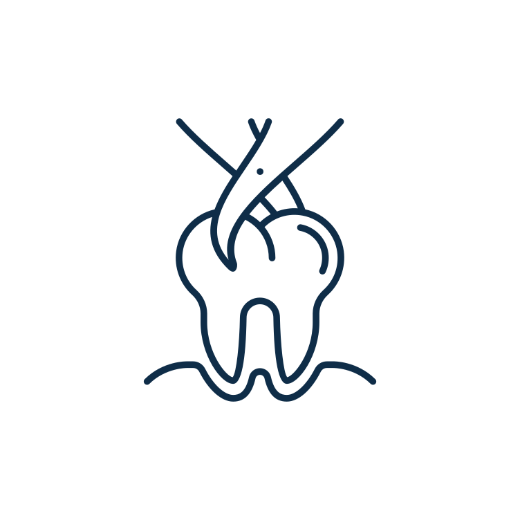 Wisdom teeth/Extraction Wisdom teeth/Extraction